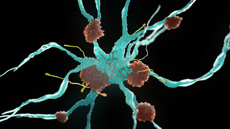 3d rendered medical illustration of nerve cells suffering from alzheimer disease