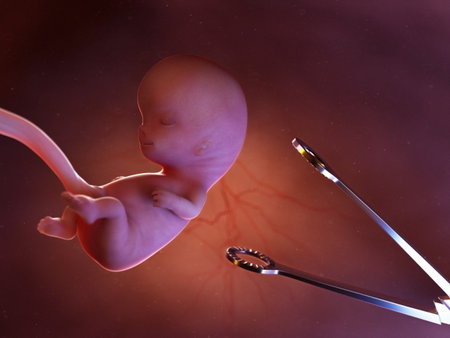 3d rendered medically accurate illustration of a conceptual abortion situationの写真素材
