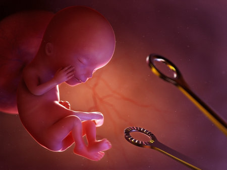 3d rendered medically accurate illustration of a conceptual abortion situationの写真素材