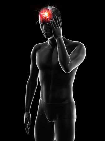 3d rendered medically accurate illustration of a painful headの写真素材