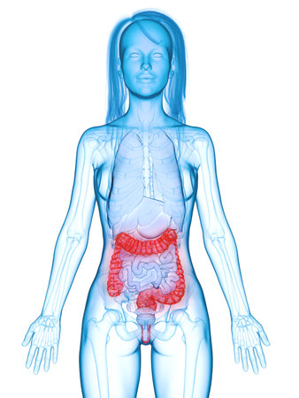 3d rendered medically accurate illustration of a diseased colonの写真素材
