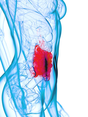 3d rendered medically accurate illustration of a diseases small intestine
