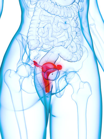 3d rendered medically accurate illustration of a diseased uterusの写真素材