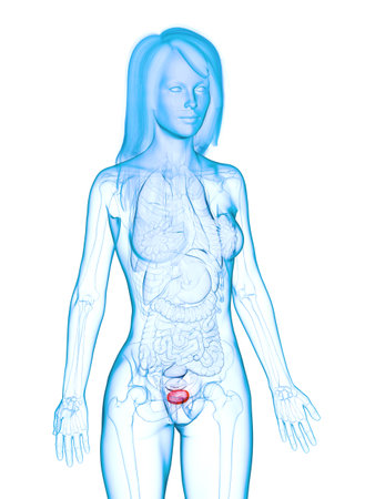3d rendered medically accurate illustration of a diseased bladderの写真素材