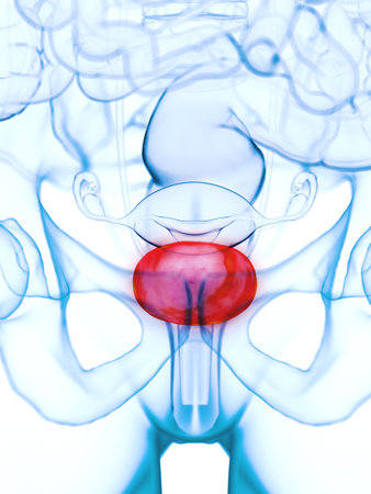 3d rendered medically accurate illustration of a diseased bladderの写真素材