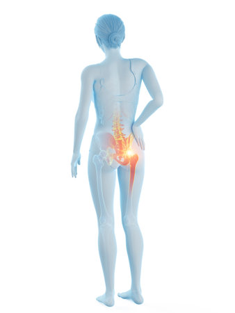 3d rendered medically accurate illustration of a woman having a painful hip