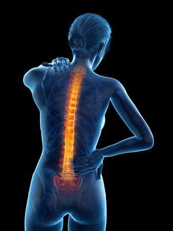 3d rendered medically accurate illustration of a woman having a backache