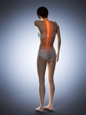 3d rendered medically accurate illustration of a woman having a backacheの写真素材
