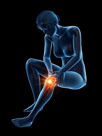 3d rendered medically accurate illustration of a woman having a painful kneeの写真素材