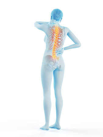 3d rendered medically accurate illustration of a woman having a backache
