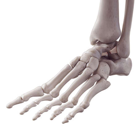 3d rendered medically accurate illustration of a torn anterior talofibular ligamentの写真素材