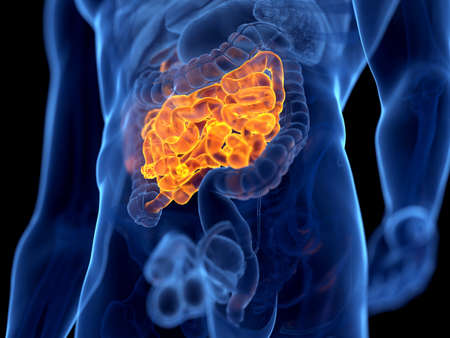 3d rendered illustration of cancer of the small intestine