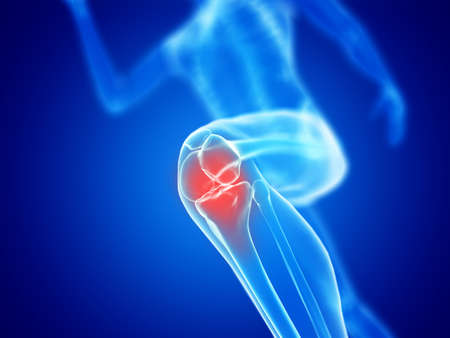3d rendered illustration of a jogger kneeの写真素材