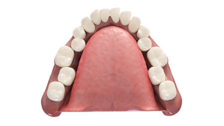3d rendered illustration of overcrowded teeth