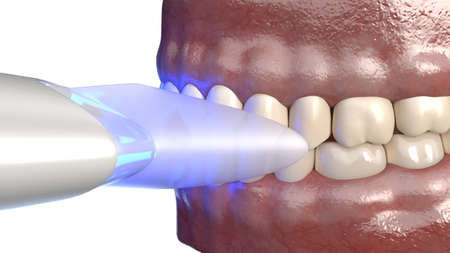3d rendered illustration of dental whitening