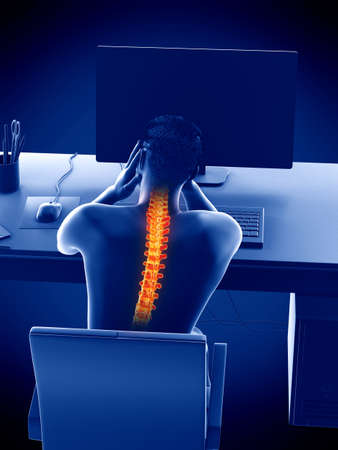 3d rendered medically accurate illustration of an office worker with backache