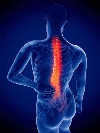 3d rendered medically accurate illustration of a mans painful back