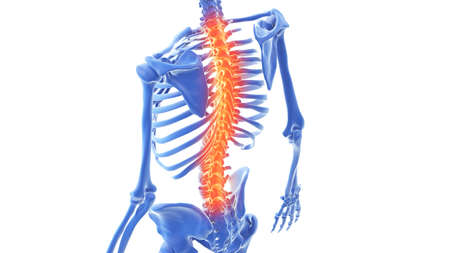 3d rendered illustration of a painful backの写真素材