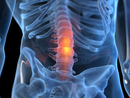 3d rendered illustration of an inflamed backの写真素材