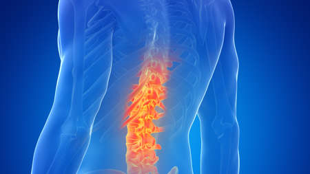 3d rendered illustration of a painful spineの写真素材