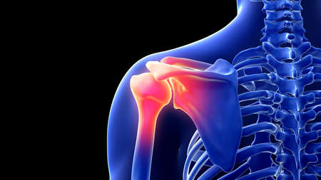 3d rendered illustration of a painful shoulderの写真素材