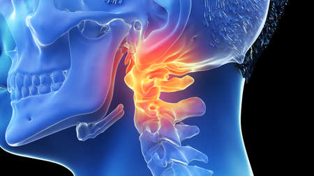 3d rendered illustration of a painful atlas boneの写真素材