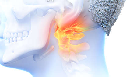 3d rendered illustration of a painful atlas boneの写真素材