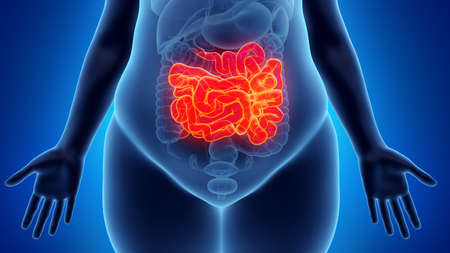 3d rendered illustration of an obese womans small intestineの写真素材