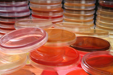 Several petri dishes for medical research