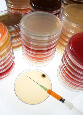 Petri dish with syringe with blood sample