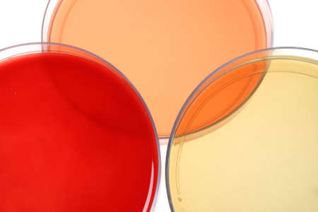 Several petri dishes for medical research