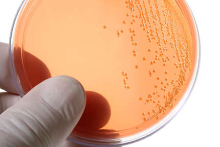 Gloved hand holding a Petri dish