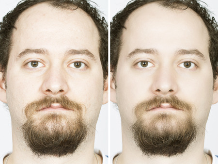 Before after facesの写真素材