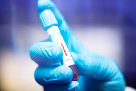 Concept of COVID-19 - Coronavirus disease - 2019-nCoV. Doctor holding blood sample for analysis and...