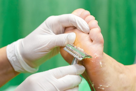 Pedicure  procedure in the beauty salon.  emover calluses on the feet. Foot care.の写真素材