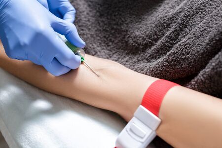 nurse taking blood sample from patient. Preparation of blood to