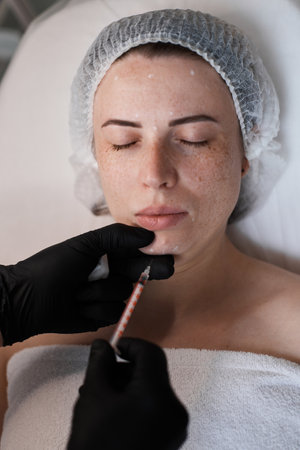 woman receives cosmetic botox injection in face.