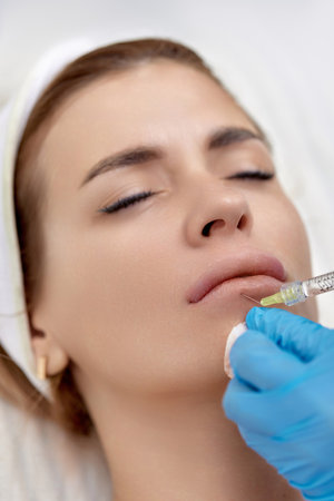 cosmetologist makes injections to enlarge the lips of beautiful woman. Lips filler injectionの写真素材