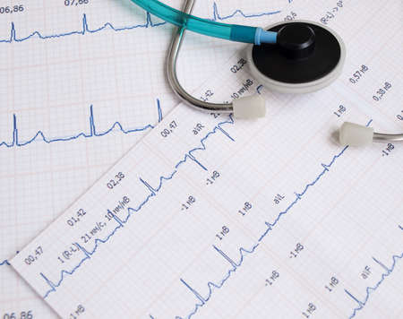 Stethoscope  on a printout of a heartrate graph