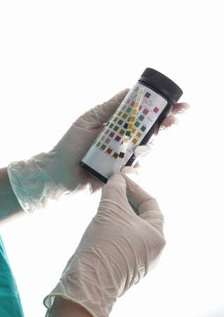 Urine test stripes examined by a nurseの写真素材