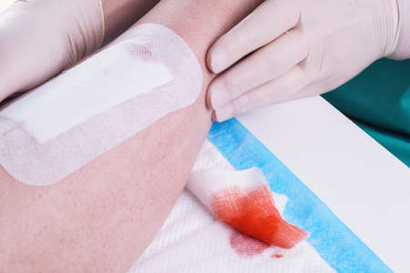 Doctor patches a Wound on the Legの写真素材