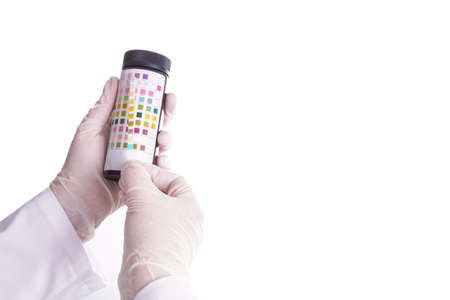 Urine test stripes examined by a nurse or doctorの写真素材