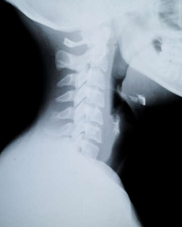 X ray of Human neck and Jaw