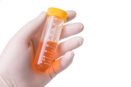 gloved hand keeps the filled sample tube, the vial is filled with a yellow liquid. Isolated on white