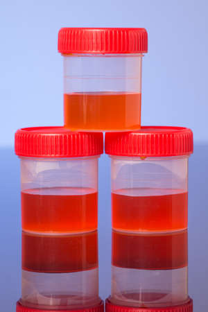 Three urine sample tube isolated on a shiny black blue backgroundの写真素材