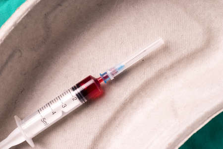 Medical syringe with bloodsample lying in a one use capsule on the hospital's green background. The...
