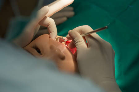 Dental treatment close-up children patient mouth with medical toolsの写真素材