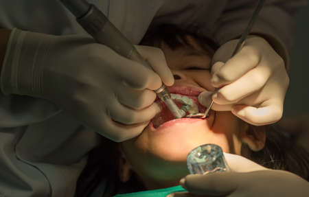 Young asian girl during dental extractionの写真素材