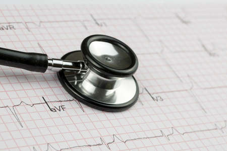 Stethoscope and red heart. Heart Check. Concept healthcare.
