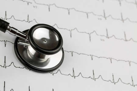 Stethoscope and red heart. Heart Check. Concept healthcare.の写真素材
